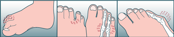 foot problems 2